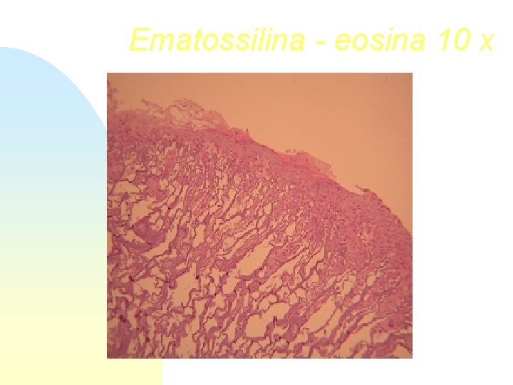 Ematossilina - eosina 10 x 