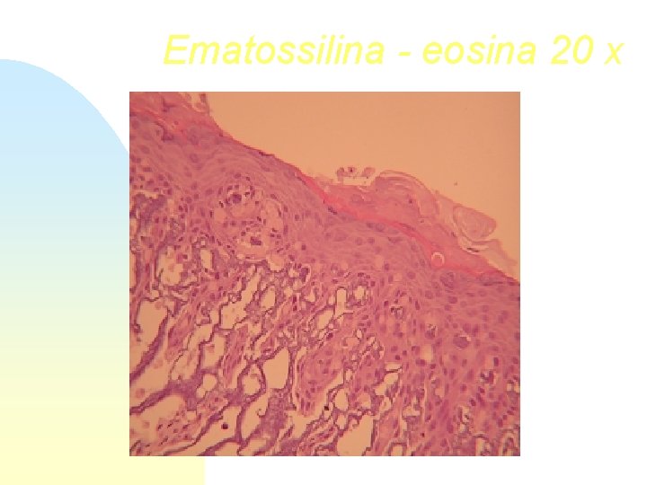 Ematossilina - eosina 20 x 