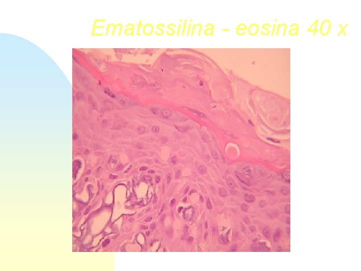 Ematossilina - eosina 40 x 