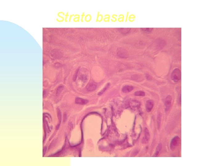 Strato basale 