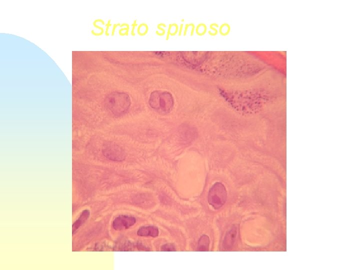 Strato spinoso 