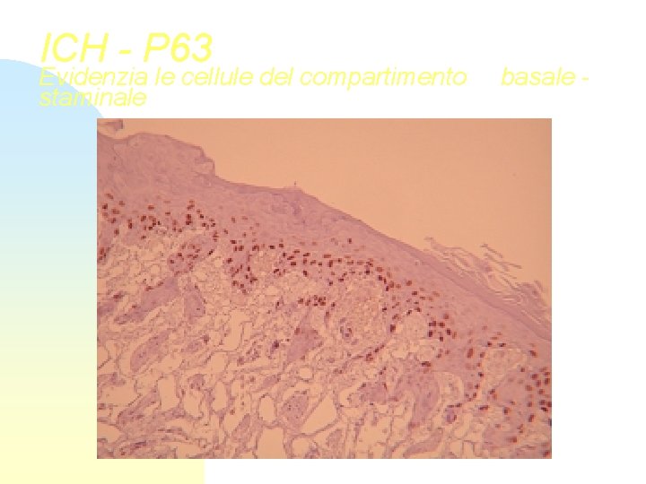 ICH - P 63 Evidenzia le cellule del compartimento staminale basale - 