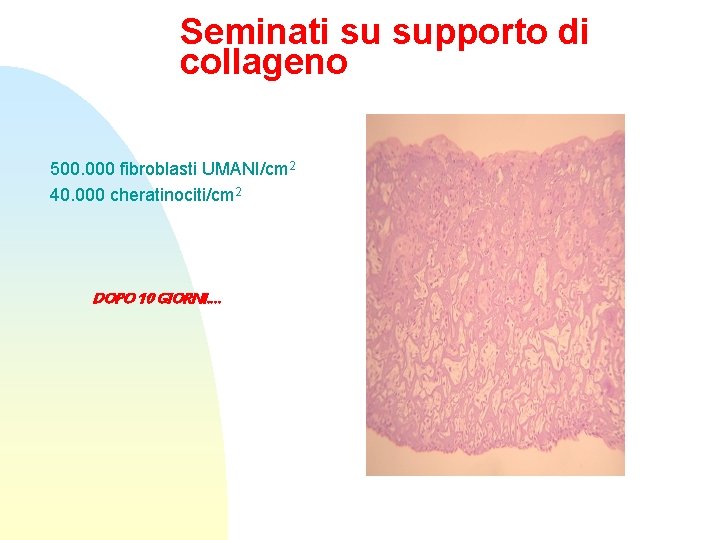 Seminati su supporto di collageno 500. 000 fibroblasti UMANI/cm 2 40. 000 cheratinociti/cm 2