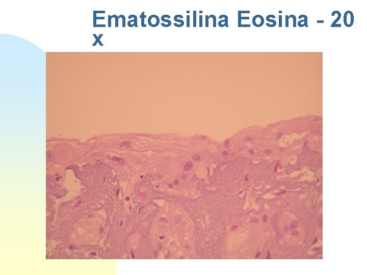 Ematossilina Eosina - 20 x 