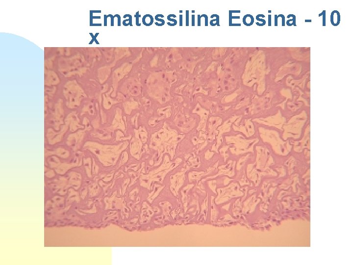 Ematossilina Eosina - 10 x 