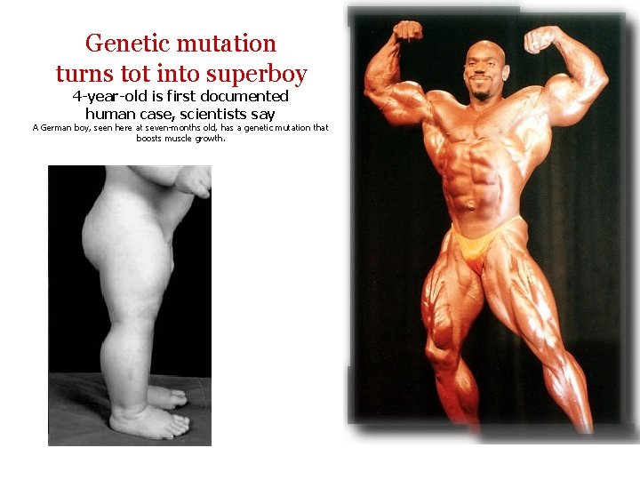 Genetic mutation turns tot into superboy 4 -year-old is first documented human case, scientists