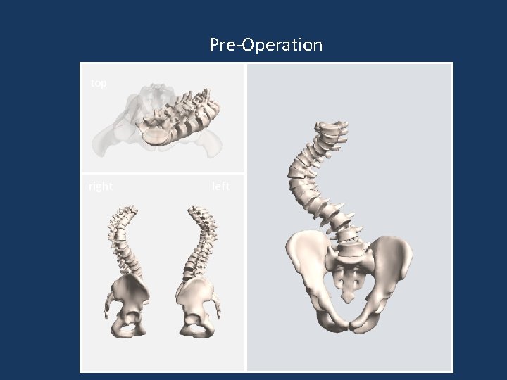 Pre-Operation top right left Pre-Operation top right left