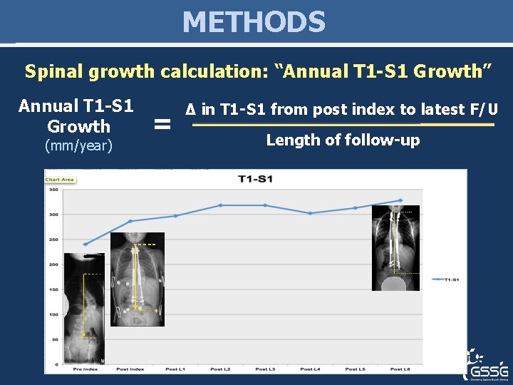 METHODS Spinal growth calculation: “Annual T 1 -S 1 Growth” Annual T 1 -S METHODS Spinal growth calculation: “Annual T 1 -S 1 Growth” Annual T 1 -S