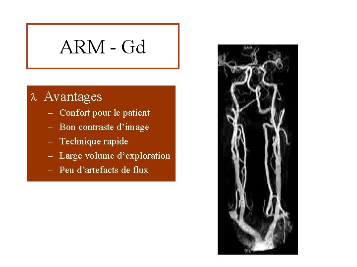 ARM - Gd l Avantages – Confort pour le patient – Bon contraste d’image