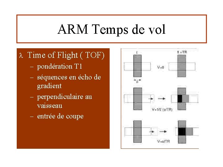 ARM Temps de vol l Time of Flight ( TOF) – pondération T 1