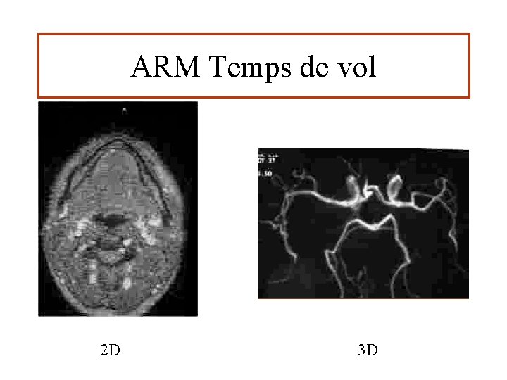 ARM Temps de vol 2 D 3 D 