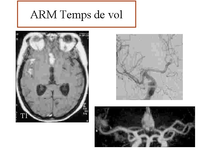 ARM Temps de vol T 1 