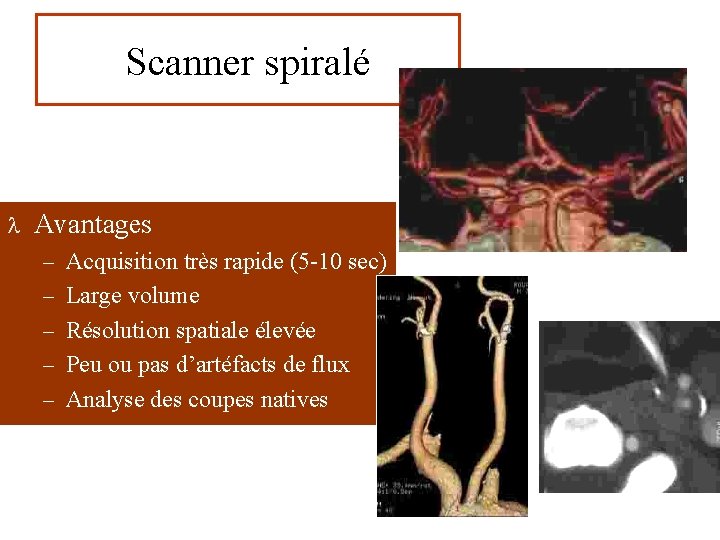 Scanner spiralé l Avantages – Acquisition très rapide (5 -10 sec) – Large volume