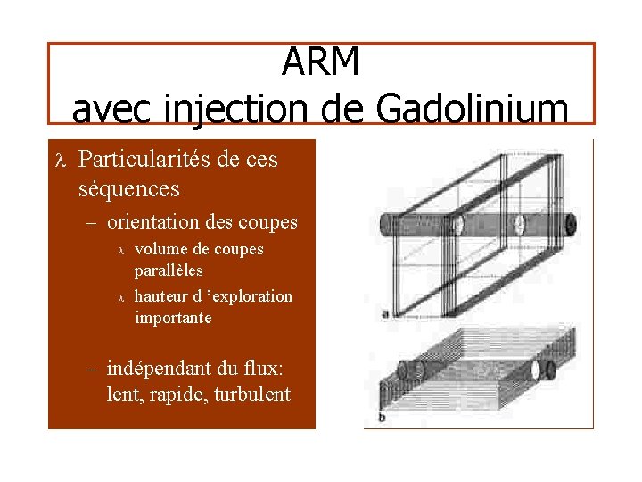 ARM avec injection de Gadolinium l Particularités de ces séquences – orientation des coupes