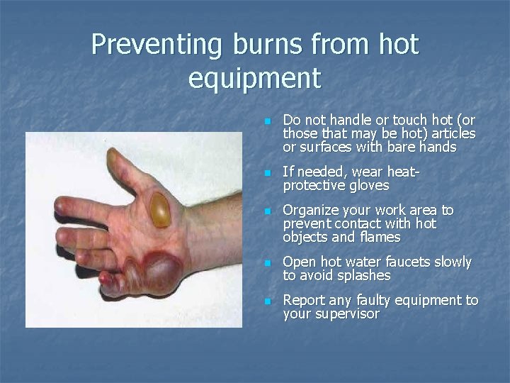 Preventing burns from hot equipment n n n Do not handle or touch hot