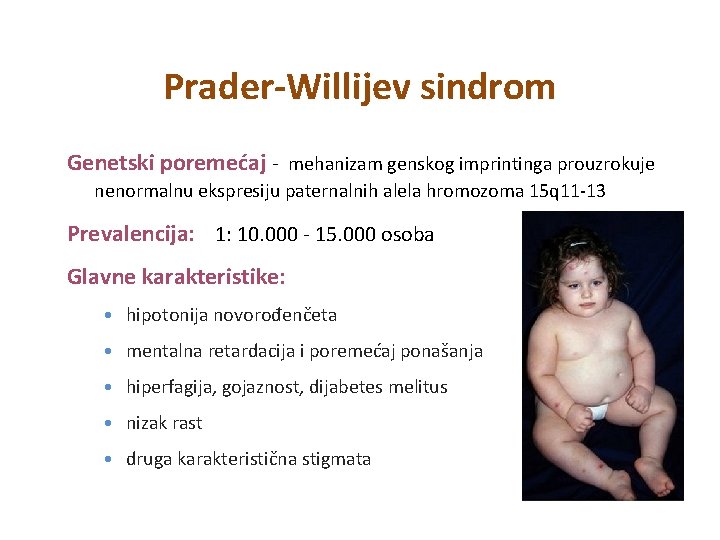 Prader-Willijev sindrom Genetski poremećaj - mehanizam genskog imprintinga prouzrokuje nenormalnu ekspresiju paternalnih alela hromozoma Prader-Willijev sindrom Genetski poremećaj - mehanizam genskog imprintinga prouzrokuje nenormalnu ekspresiju paternalnih alela hromozoma