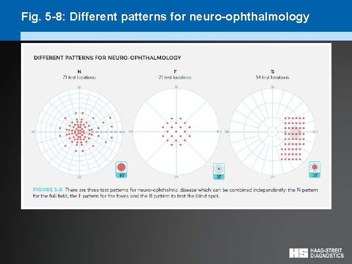 Fig. 5 -8: Different patterns for neuro-ophthalmology 
