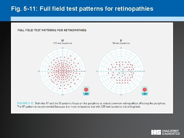 Fig. 5 -11: Full field test patterns for retinopathies 