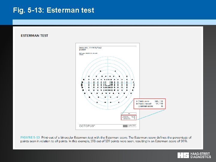 Fig. 5 -13: Esterman test 