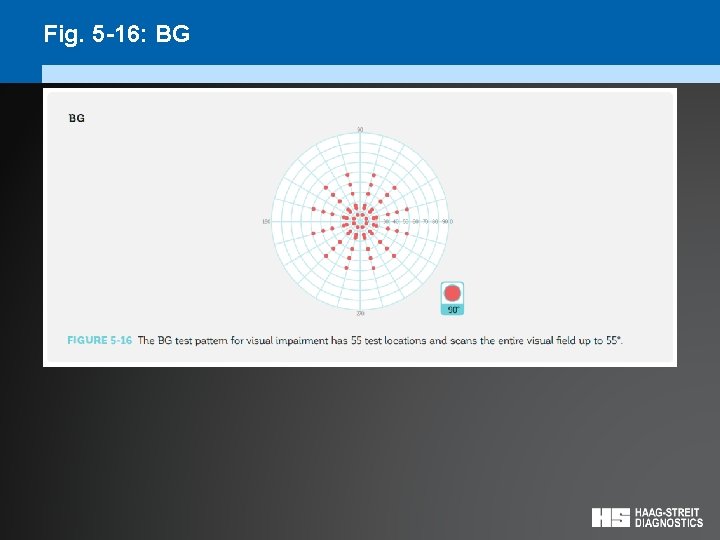 Fig. 5 -16: BG 