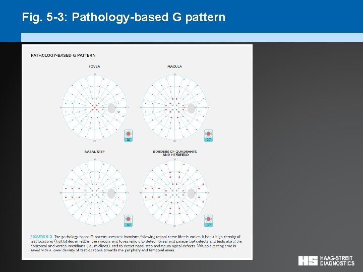 Fig. 5 -3: Pathology-based G pattern 