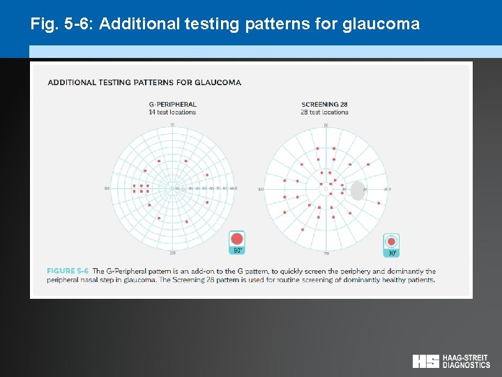 Fig. 5 -6: Additional testing patterns for glaucoma 