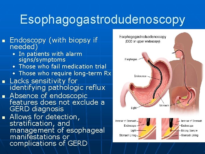 Esophagogastrodudenoscopy n Endoscopy (with biopsy if needed) • In patients with alarm signs/symptoms •