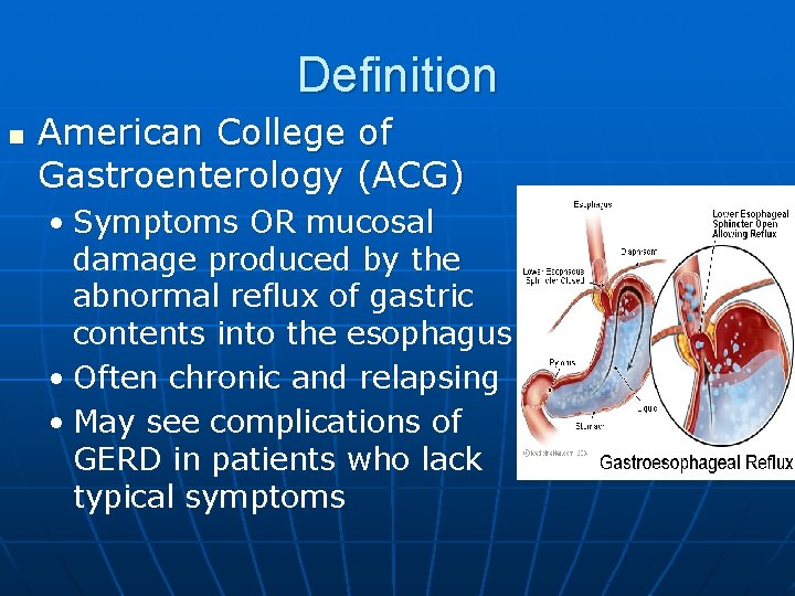 Definition n American College of Gastroenterology (ACG) • Symptoms OR mucosal damage produced by