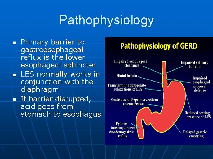 Pathophysiology n n n Primary barrier to gastroesophageal reflux is the lower esophageal sphincter