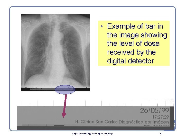  • Example of bar in the image showing the level of dose received