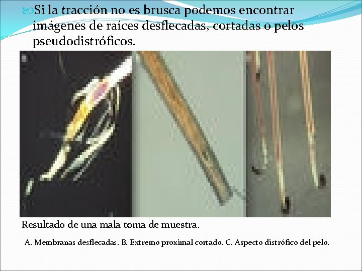  Si la tracción no es brusca podemos encontrar imágenes de raíces desflecadas, cortadas