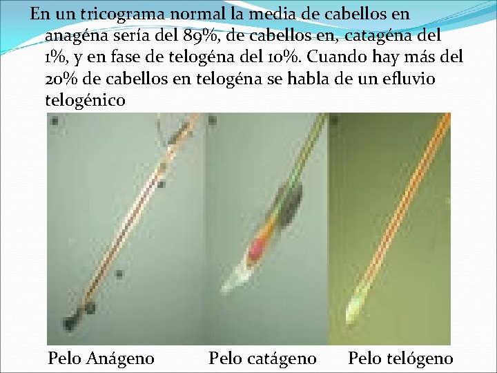 En un tricograma normal la media de cabellos en anagéna sería del 89%, de