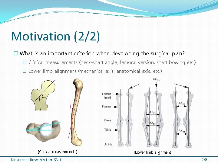 Motivation (2/2) � What is an important criterion when developing the surgical plan? �