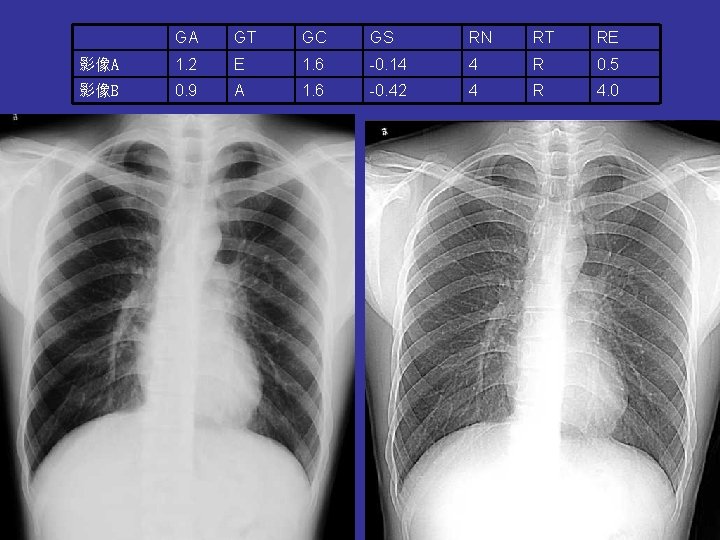 GA GT GC GS RN RT RE 影像A 1. 2 E 1. 6 -0. GA GT GC GS RN RT RE 影像A 1. 2 E 1. 6 -0.