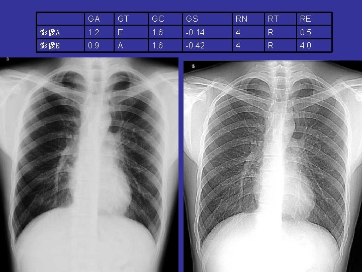 GA GT GC GS RN RT RE 影像A 1. 2 E 1. 6 -0.