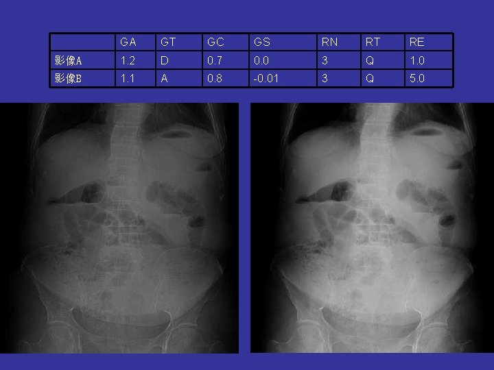 GA GT GC GS RN RT RE 影像A 1. 2 D 0. 7 0. GA GT GC GS RN RT RE 影像A 1. 2 D 0. 7 0.