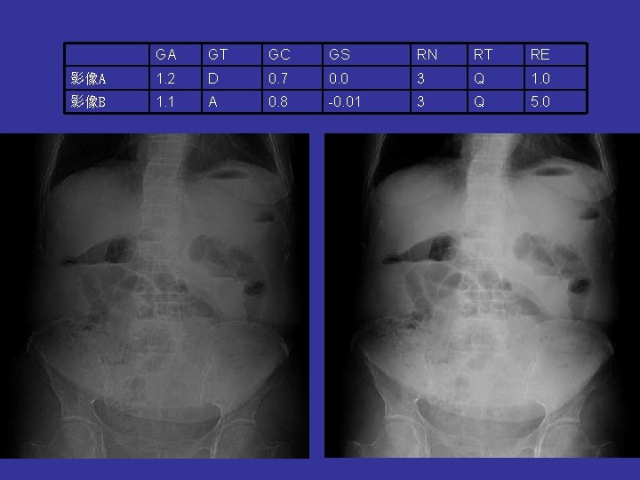GA GT GC GS RN RT RE 影像A 1. 2 D 0. 7 0.