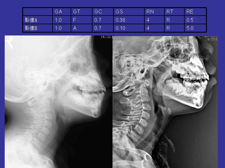 GA GT GC GS RN RT RE 影像A 1. 0 F 0. 7 0. GA GT GC GS RN RT RE 影像A 1. 0 F 0. 7 0.