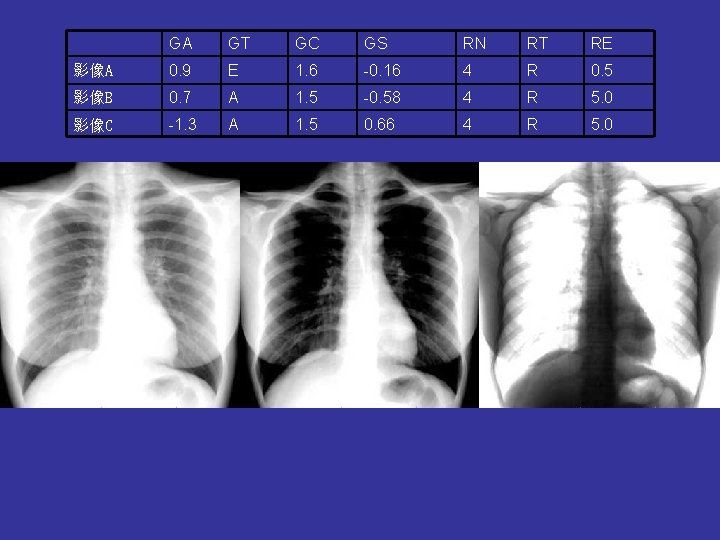 GA GT GC GS RN RT RE 影像A 0. 9 E 1. 6 -0. GA GT GC GS RN RT RE 影像A 0. 9 E 1. 6 -0.