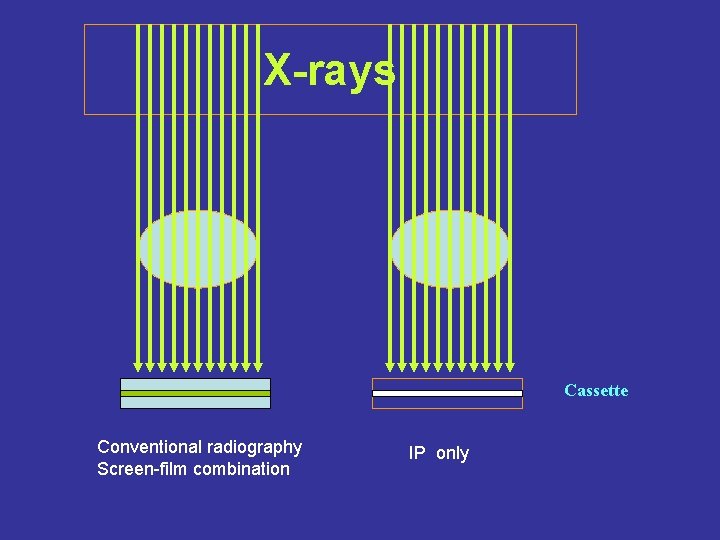 X-rays Cassette Conventional radiography Screen-film combination IP only 