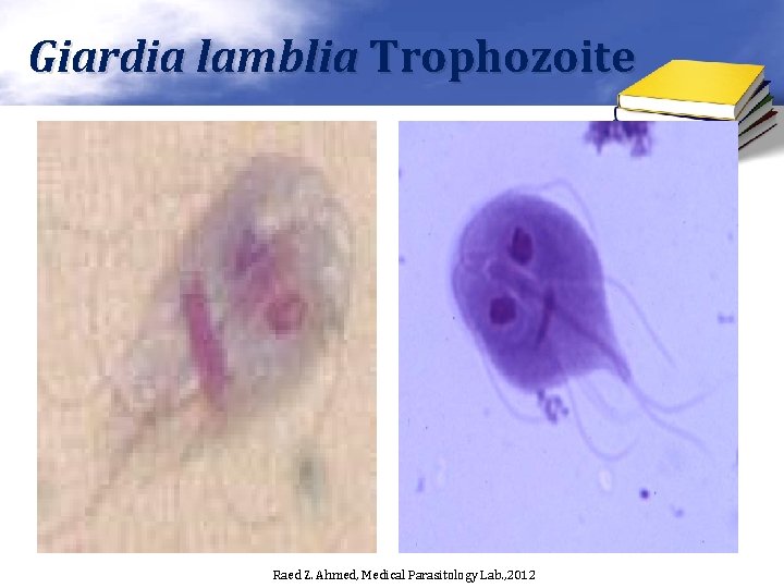 Giardia lamblia Trophozoite Raed Z. Ahmed, Medical Parasitology Lab. , 2012 