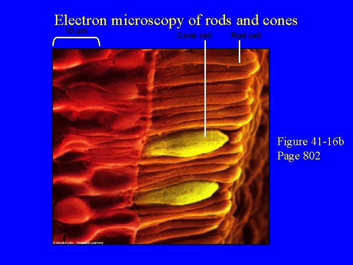Electron microscopy of rods and cones 10 µm Cone cell Rod cell Figure 41