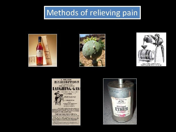 Methods of relieving pain 