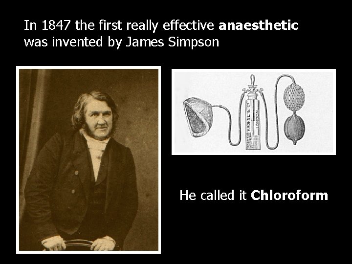In 1847 the first really effective anaesthetic was invented by James Simpson He called
