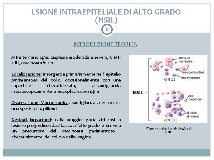 LSIONE INTRAEPITELIALE DI ALTO GRADO (HSIL) 12 INTRODUZIONE TEORICA Altra terminologia: displasia moderada e