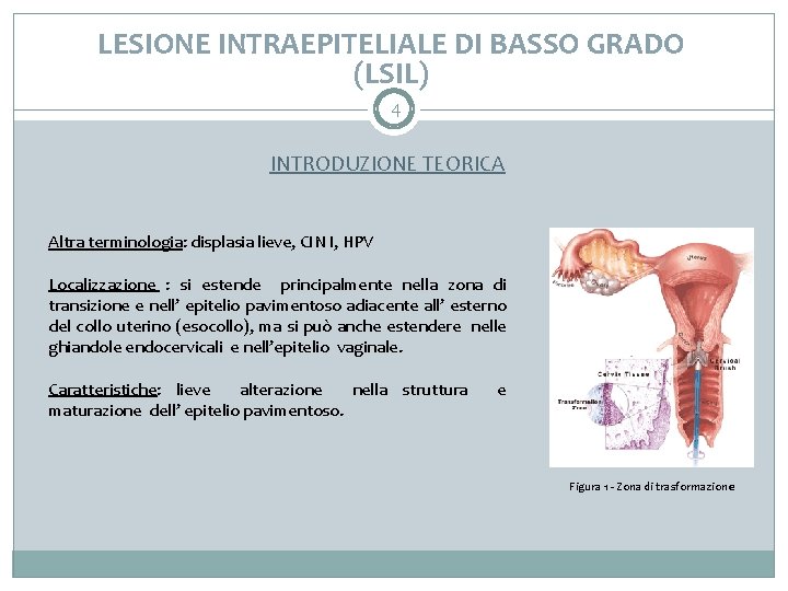 LESIONE INTRAEPITELIALE DI BASSO GRADO (LSIL) 4 INTRODUZIONE TEORICA Altra terminologia: displasia lieve, CIN