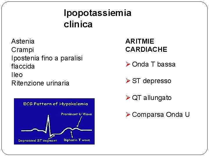 Ipopotassiemia clinica Astenia Crampi Ipostenia fino a paralisi flaccida Ileo Ritenzione urinaria ARITMIE CARDIACHE