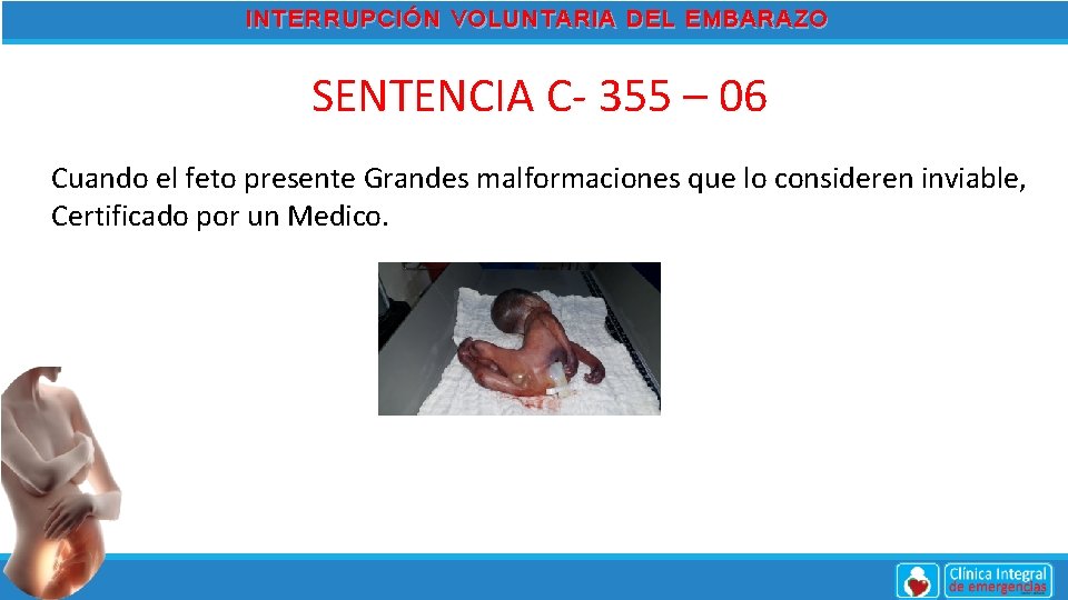 INTERRUPCIÓN VOLUNTARIA DEL EMBARAZO SENTENCIA C- 355 – 06 Cuando el feto presente Grandes
