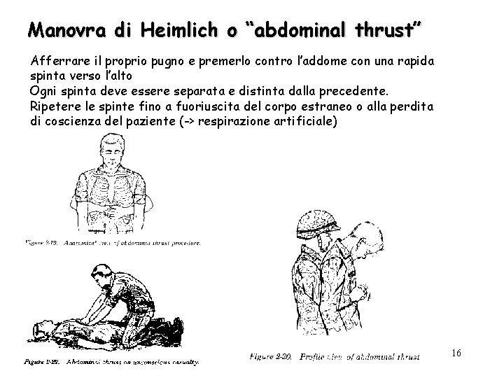 Manovra di Heimlich o “abdominal thrust” Afferrare il proprio pugno e premerlo contro l’addome