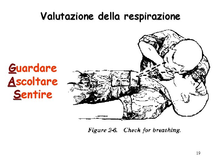 Valutazione della respirazione Guardare Ascoltare Sentire 19 
